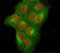Immunofluorescent staining of FFPE human U-2 OS cells with NCOR2 antibody (red) and Beta Tubulin mAb (green). HIER: steam section in pH6 citrate buffer for 20 min.
