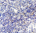 IHC staining of FFPE human tonsil tissue with FOXP3 antibody, HRP-labeled secondary and DAB substrate. HIER: boil tissue sections in pH8 EDTA for 20 min and allow to cool before testing.