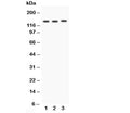 Western blot testing of Integrin alpha 1 antibody and Lane 1: rat brain; 2: HeLa; 3: SW620; Predicted molecular weight: ~131/150+ kDa (unmodified/glycosylated).