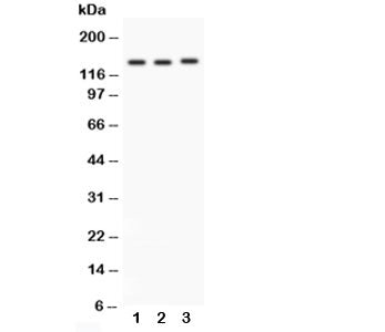 Western blot testing of Integrin alpha 1 antibody and Lane 1: rat brain; 2: HeLa; 3: SW620; Predicted molecular weight: ~131/150+ kDa (unmodified/glycosylated).