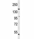 Western blot analysis of KDR antibody and mouse lung tissue lysate. Predicted molecular weight: ~152 (immature), 180-200 kDa (intermediate) and 220-230 kDa (mature).