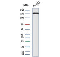 Western blot testing of A431 lysate using EGFR antibody. Expected molecular weight: 134-180 kDa depending on glycosylation level.