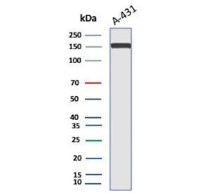 Western blot testing of A431 lysate using EGFR antibody. Expected molecular weight: 134-180 kDa depending on glycosylation level.