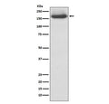 Western blot testing of human 293T cell lysate with NF-M antibody. Predicted molecular weight: ~102 kDa but routinely observed at 145~160 kDa.