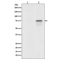 Western blot testing of human 293T cells 1) untreated and 2) treated with Okadaic Acid + Calyculin A, with phospho-Raf1 antibody. Predicted molecular weight ~73 kDa.