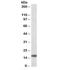 Western blot testing of human colorectal cancer lysate with RPL23 antibody at 0.1ug/ml. Predicted molecular weight: ~15kDa.