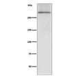 Western blot testing of human fetal heart lysate with Dystrophin antibody. Predicted molecular weight ~427 kDa.