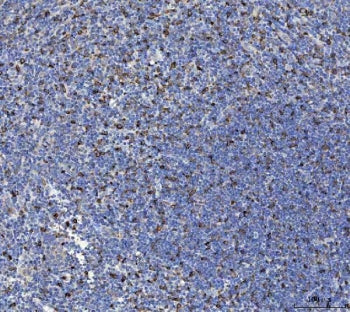 IHC staining of FFPE human tonsil tissue with Interleukin 10 antibody. HIER: boil tissue sections in pH8 EDTA for 20 min and allow to cool before testing.