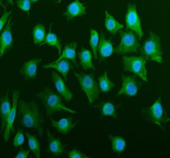 Immunofluorescent staining of Tubulin Alpha using anti-Alpha Tubulin antibody (green). Tubulin Alpha was detected in an immunocytochemical section of cells. Enzyme antigen retrieval was performed using IHC enzyme antigen retrieval reagent for 15 mins. The cells were blocked with 10% goat serum. And then incubated with 5 ug/ml rabbit anti-Alpha Tubulin antibody overnight at 4oC. DyLight 488 Conjugated Goat Anti-Rabbit IgG was used as secondary antibody at 1:500 dilution and incubated for 30 min at 37oC.