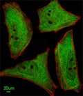 Immunofluorescent analysis of HeLa cells using Ubiquilin1 antibody; Ab was diluted at 1:100 dilution. Alexa Fluor 488-conjugated goat anti-rabbit lgG was used as the secondary Ab (green). Cytoplasmic actin was counterstained with Dylight Fluor 554 (red) conjugated Phalloidin (red).
