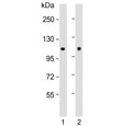 Western blot testing of human 1) MCF7 and 2) rat brain lysate with Hexokinase antibody. Predicted molecular weight ~102 kDa.