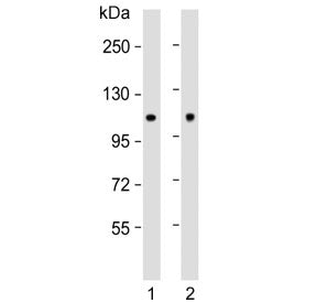 Western blot testing of human 1) MCF7 and 2) rat brain lysate with Hexokinase antibody. Predicted molecular weight ~102 kDa.