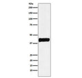 Western blot testing of human SH-SY5Y cell lysate with CKB antibody. Predicted molecular weight ~43 kDa.