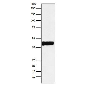 Western blot testing of human SH-SY5Y cell lysate with CKB antibody. Predicted molecular weight ~43 kDa.