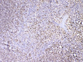 IHC testing of FFPE human tonsil tissue with PAX5 antibody at 1ug/ml. Required HIER: steam section in pH6 citrate buffer for 20 min and allow to cool prior to testing.