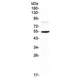 Western blot testing of mouse HEPA1-6 cell lysate with ANGPTL3 antibody at 0.5ug/ml. Expected molecular weight 50 ~ 63 kDa depending on glycosylation level.