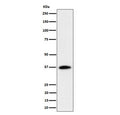 Western blot testing of human Jurkat cell lysate with RASSF2 antibody. Predicted molecular weight ~38 kDa.