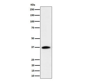 Western blot testing of human Jurkat cell lysate with RASSF2 antibody. Predicted molecular weight ~38 kDa.