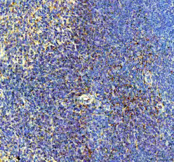 IHC staining of FFPE mouse spleen tissue with BCA1 antibody, HRP-secondary and DAB substrate. HIER: boil tissue sections in pH8 EDTA for 20 min and allow to cool before testing.