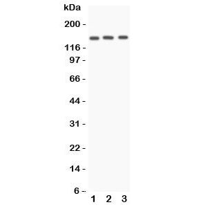 Western blot testing of Angiotensin Converting Enzyme antibody and Lane 1: A549; 2: HeLa; 3: 22RV1 lysate. Expected molecular weight 140-170 kDa.