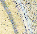IHC staining of FFPE mouse brain tissue with NFIA antibody, HRP-secondary and DAB substrate. HIER: boil tissue sections in pH8 EDTA for 20 min and allow to cool before testing.