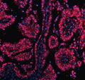 Immunofluorescent staining of PRDM11 using anti-PRDM11 antibody and anti-Tubulin Alpha antibody. PRDM11 was detected in immunocytochemical section of Hela cell. Enzyme antigen retrieval was performed using IHC enzyme antigen retrieval reagent for 15 mins. The cells were blocked with 10% goat serum. And then incubated with 5 ug/ml rabbit anti-PRDM11 antibody and mouse anti-Tubulin Alpha antibody overnight at 4oC.