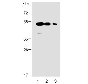 Western blot testing of human 1) brain, 2) breast and 3) placenta lysate with ENT1 antibody. Predicted molecular weight ~50 kDa.