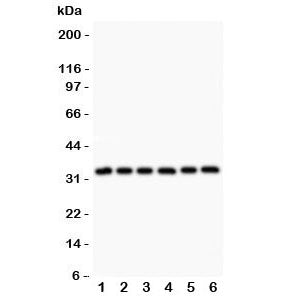 Western blot testing of MyD88 antibody and Lane 1: rat heart; 2: human HeLa; 3: (h) MCF7; 4: (h) HEPG2; 5: (h) Jurkat; 6: (h) Raji lysate. Predicted molecular weight: 33 kDa