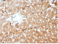 IHC staining of FFPE human liver tissue with Haptoglobin antibody (clone HP/3839) at 2ug/ml. HIER: boil tissue sections in pH 9 10mM Tris with 1mM EDTA for 20 min and allow to cool before testing.