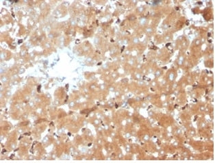 IHC staining of FFPE human liver tissue with Haptoglobin antibody (clone HP/3839) at 2ug/ml. HIER: boil tissue sections in pH 9 10mM Tris with 1mM EDTA for 20 min and allow to cool before testing.