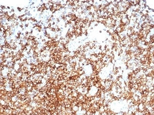 IHC staining of FFPE human tonsil with CD13 antibody (clone APN/6998). HIER: boil tissue sections in pH 9 10mM Tris with 1mM EDTA for 20 min and allow to cool before testing.