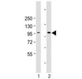 Western blot testing of HACE1 antibody at 1:2000: Lane 1) human HEK293 and 2) 293T/17 cell lysate. Predicted molecular weight ~102 kDa.