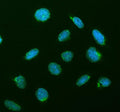 Immunofluorescent staining of CREB3L2 using anti-CREB3L2 antibody (green). CREB3L2 was detected in an immunocytochemical section of U2OS cells. Enzyme antigen retrieval was performed using IHC enzyme antigen retrieval reagent for 15 mins. The cells were blocked with 10% goat serum. And then incubated with 5 ug/ml rabbit anti-CREB3L2 antibody overnight at 4oC. DyLight 488 Conjugated Goat Anti-Rabbit IgG was used as secondary antibody at 1:500 dilution and incubated for 30 min at 37oC.