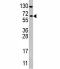 Western blot analysis of CDC25B antibody and Ramos lysate. Expected/observed molecular weight: 61~67kDa (isoforms 1-4).