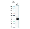 Western blot testing of human Raji cell lysate with recombinant CD74 antibody (clone CLIP/3127R). Expected molecular weight: 33-43 kDa.