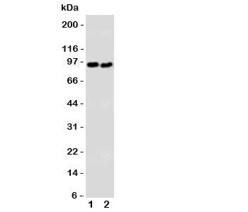 Western blot testing of DISC1 antibody and Lane 1: U87; 2: SHG-44 cell lysate. Expected/observed molecular weight: ~94kDa.