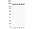 Western blot testing of PAPP-A antibody and human samples 1: placenta; 2: HT1080; 3: SKOV; 4: 22RV1; 5: SW620; 6: MM231 lysate. Predicted/observed size ~180KD