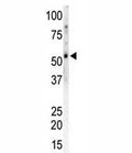 Western blot of CAMK2G and mouse heart tissue lysate