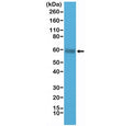 Western blot testing of human Jurkat cell lysate with recombinant CD5 antibody at 1:1000 dilution. Observed molecular weight: 55~67 kDa depending on glycosylation level.