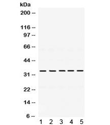 Western blot testing of 1) rat kidney, 2) mouse ovary, 3) human HeLa, 4) human MCF7 and 5) human SMMC lysate with TIMP3 antibody. Expected/observed molecular weight: ~24/33 kDa (unmodified/glycosylated).