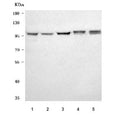 Western blot testing of 1) human HeLa, 2) human 293T, 3) human K562, 4) rat brain and 5) mouse brain tissue lysate with NAA15 antibody. Predicted molecular weight ~101 kDa.