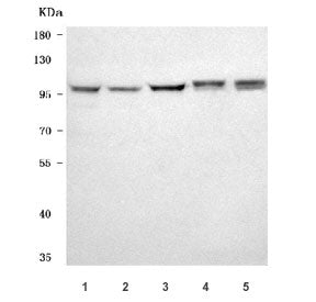 Western blot testing of 1) human HeLa, 2) human 293T, 3) human K562, 4) rat brain and 5) mouse brain tissue lysate with NAA15 antibody. Predicted molecular weight ~101 kDa.