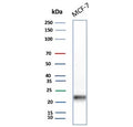 Western blot testing of human MCF7 cell lysate with MGMT antibody. Predicted molecular weight: ~23 kDa.