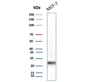 Western blot testing of human MCF7 cell lysate with MGMT antibody. Predicted molecular weight: ~23 kDa.