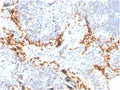 IHC staining of FFPE human lymph node with HAVCR2 antibody (clone TIM3/4024). HIER: boil tissue sections in pH 9 10mM Tris with 1mM EDTA for 20 min and allow to cool before testing.
