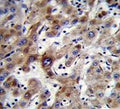 IHC testing of FFPE human liver tissue with ADP,ATP carrier protein 3 antibody. HIER: steam section in pH6 citrate buffer for 20 min and allow to cool prior to staining.