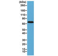 Western blot of human brain lysate using recombinant Neurofilament antibody at 1:2500. Predicted molecular weight: 62-68 kDa.