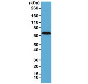 Western blot of human brain lysate using recombinant Neurofilament antibody at 1:2500. Predicted molecular weight: 62-68 kDa.