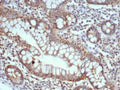 IHC staining of FFPE human small intestine tissue with Calbindin D9K antibody (clone S100G/7516). HIER: boil tissue sections in pH 9 10mM Tris with 1mM EDTA for 20 min and allow to cool before testing.
