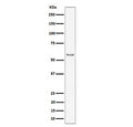 Western blot testing of mouse heart tissue lysate with Intercellular adhesion molecule 2 antibody. Expected molecular weight: 31-60 kDa depending on glycosylation level.